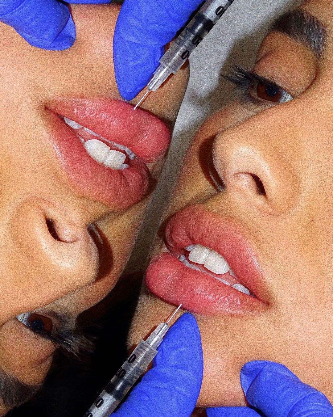 More slurping less slicing